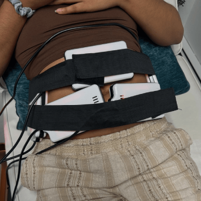 LASER LIPO SERVICES